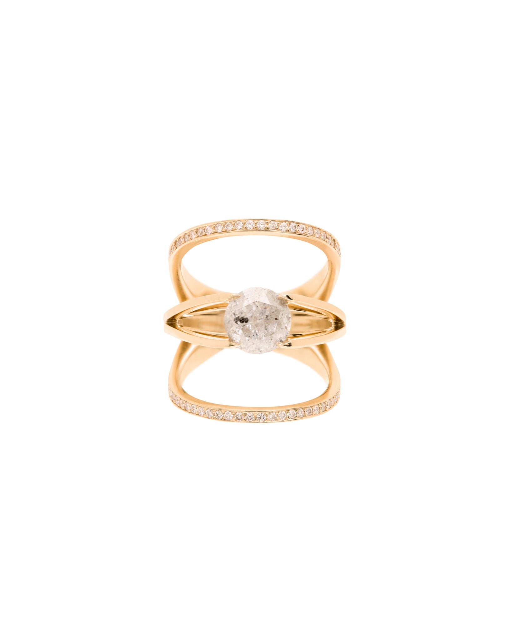 Acute 22mm Enclose + Centered Ring Set